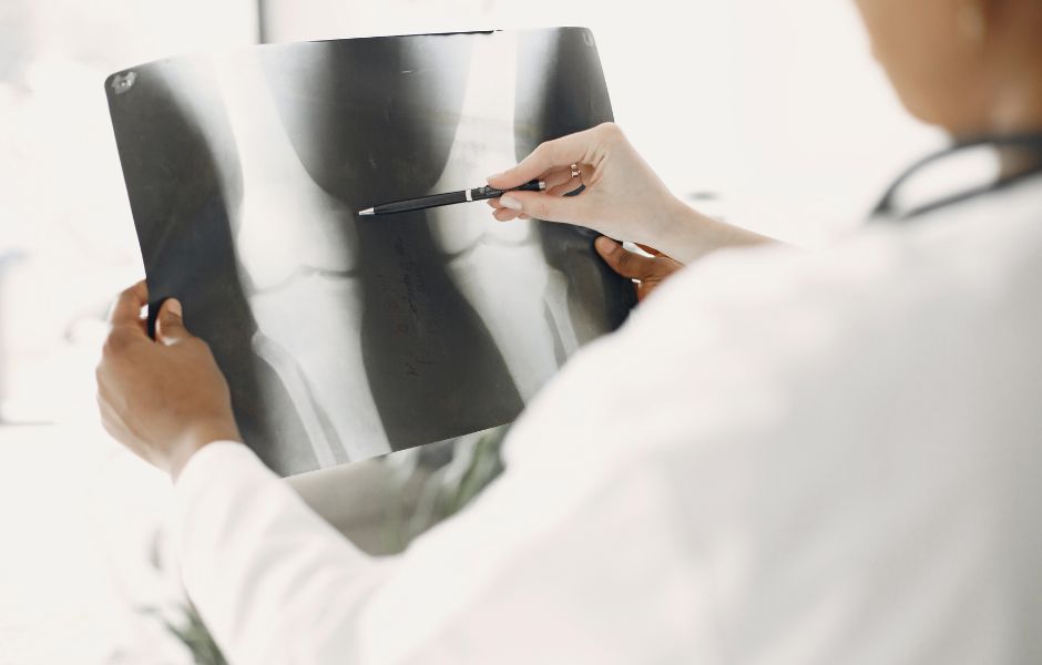 Radiografía con signos de artrosis de cadera y rodilla Radiografía con signos de artrosis de cadera y rodilla